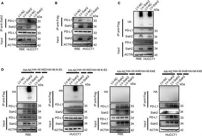 Corrigendum: Decreased expression of programmed death ligand-L1 by seven in absentia homolog 2 in cholangiocarcinoma enhances T-cell–mediated antitumor activity